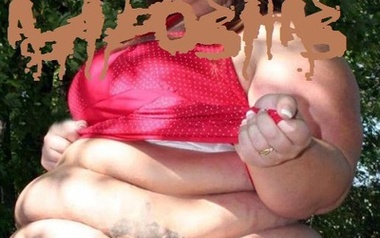 Adipositas Adipositas