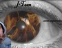 J-Teen