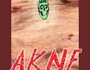 A K N E
