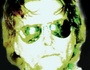 STU