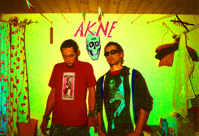 A K N E - Richtfest