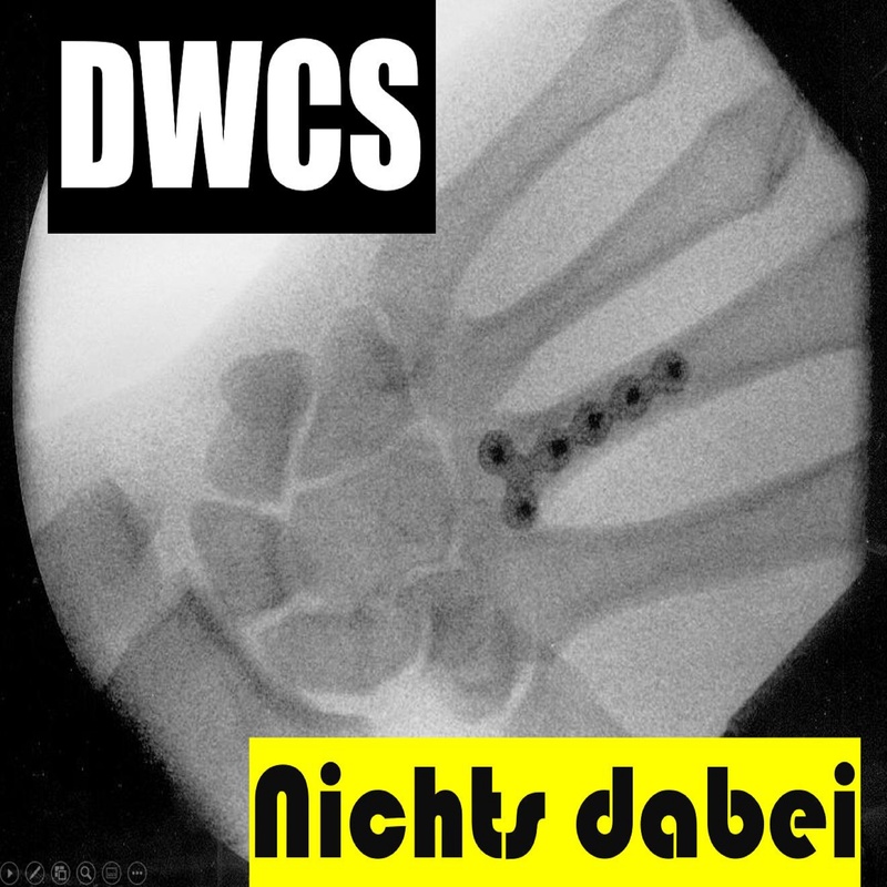 DWCS - Nichts dabei